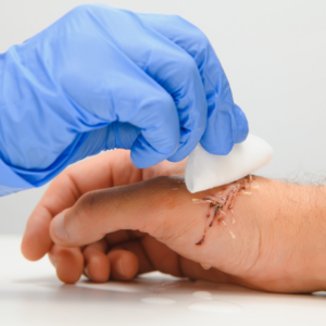 Curación y cuidado de heridas